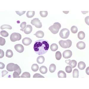 Human Neutrophil White Blood Cell or Leukocyte Surrounded by Red Blood 