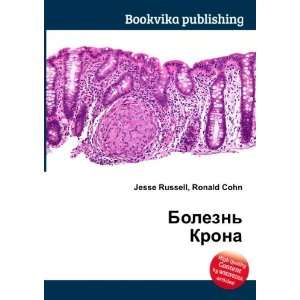  Bolezn Krona (in Russian language): Ronald Cohn Jesse 