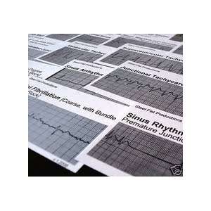 EKG ECG Cardiac Acls Rhythm Strip Flashcards Everything 