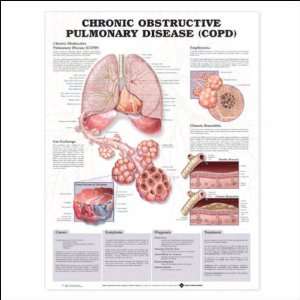Chronic Obstructive Pulmonary Disease (COPD) Anatomical Chart 20 X 26 
