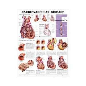Cardiovascular Disease Anatomical Chart  Industrial 
