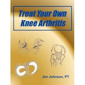  Treat Your Own Knee Arthritis [Paperback] Jim Johnson 
