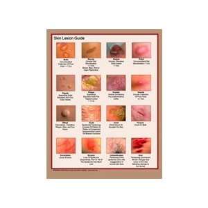  Skin Lesions Quick Reference Guide 