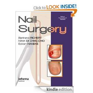 Nail Surgery (Series in Dermatological Treatment) Bertrand Richert 