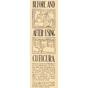  1911 Ad Potter Drug & Chemical Corp. Cuticura Ointment 
